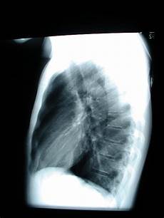 Diaphragm